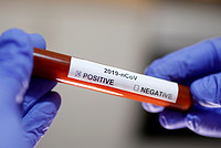 First novel coronavirus vaccines begin animal testing