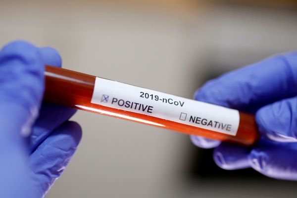 Novel coronavirus has not mutated: Top expert